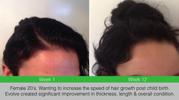 Zenagen shampoo sales