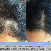 Avante Hair Restoration Serum Spray 50ml