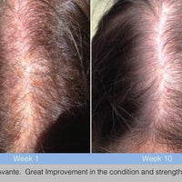 Avante Hair Restoration Serum Spray 50ml