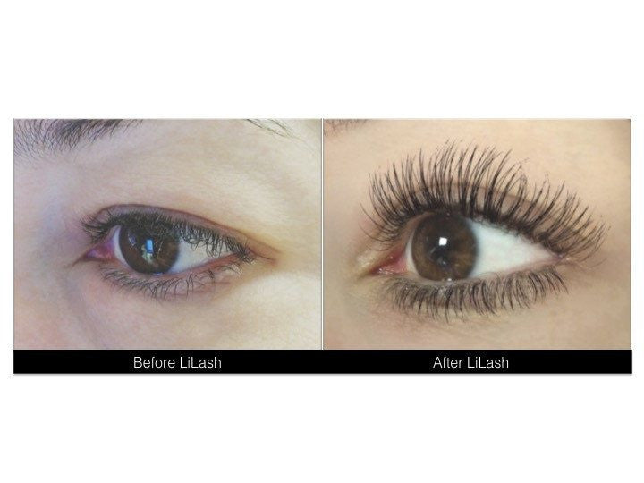 LiLash Eyelash Serum