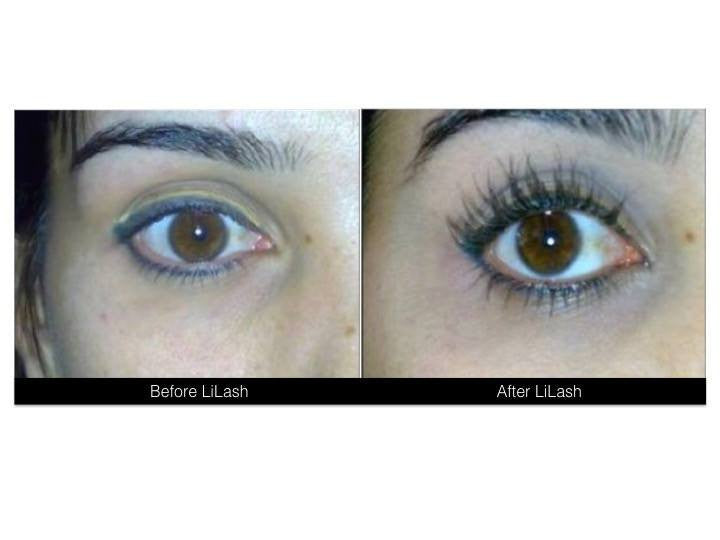 LiLash Eyelash Serum