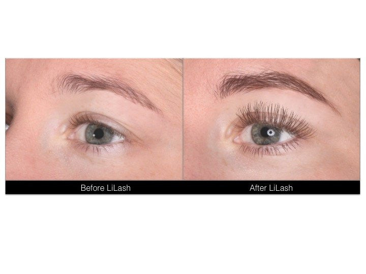 LiLash Eyelash Serum