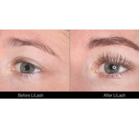 LiLash Eyelash Serum